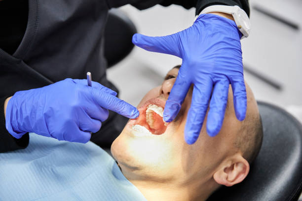 Best Emergency Treatment for Dental Infections or Abscesses in El Reno, OK
